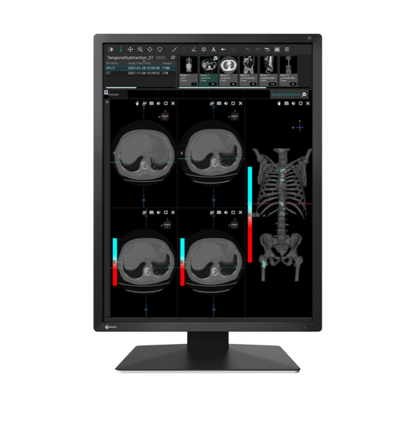 Eizo MX217 2MP 21" Radiology Monitor